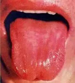 舌苔厚的明星网红,揭秘明星舌苔背后的健康密码