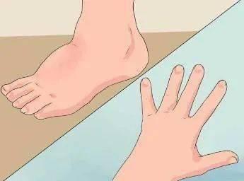 孕妈热门吃瓜事件,孕妈热门事件背后的真相与争议