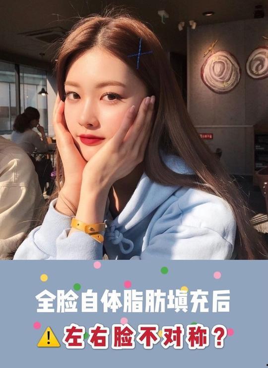 脂肪填充失败明星网红,明星网红的美丽陷阱揭秘