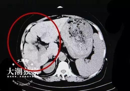 ccgg.ct今日吃瓜,揭秘娱乐圈最新热点事件