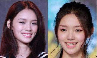 明星网红同款牙缸,明星同款口腔护理新潮流